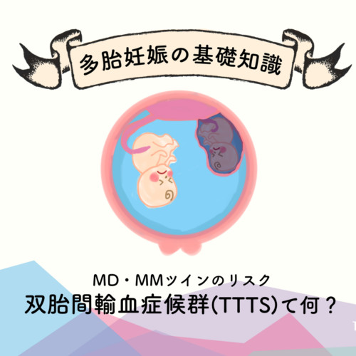 双胎間輸血症候群とは