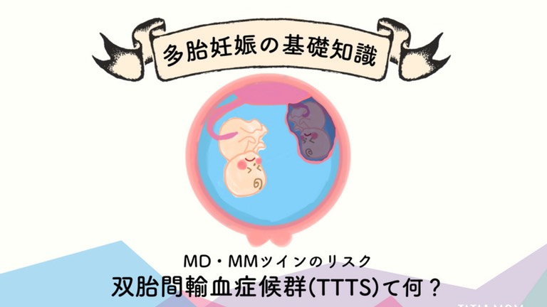 双胎間輸血症候群TTTSとは