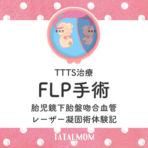 FLP手術 体験 経験 TTTS レーザー治療
